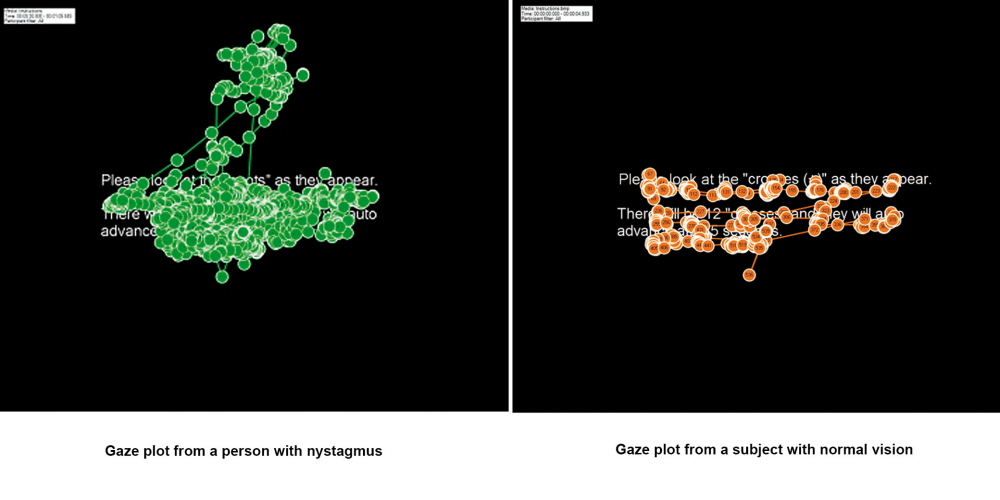Gaze plots from a person with nystagmus (on the left) and without  nystagmus (on the right).